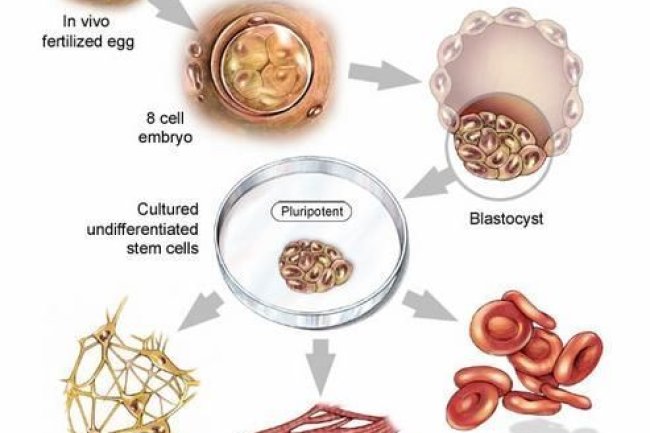 Development of Stem Cell Therapy in Indonesia