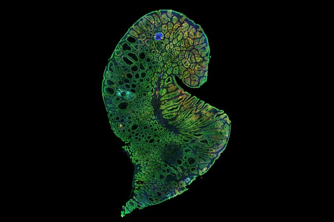 How does the body renew itself  with stem cell